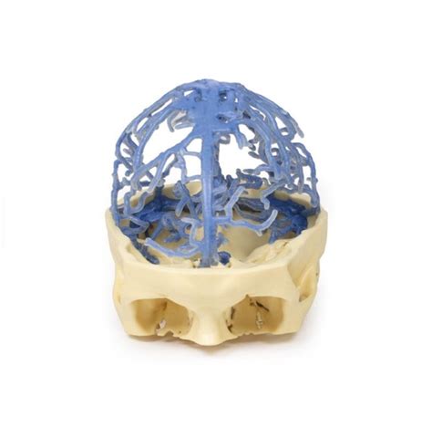 3D Printed Anatomical Model