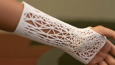 3D Printed Medical Device