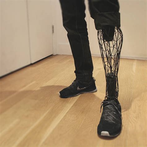 3D Printed Prosthetic