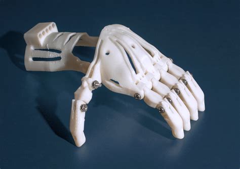 3D Printed Prosthetics