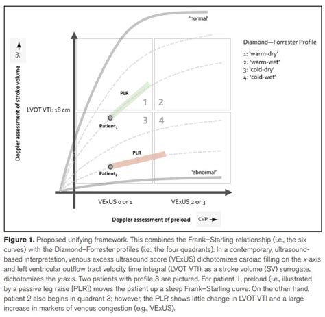 IVC Integration