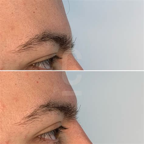 Brow Bone Contouring Techniques