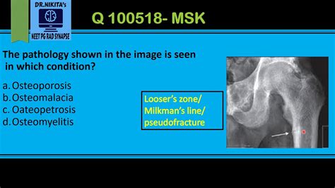 Causes of Major Loser Syndrome