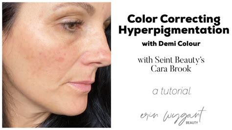 Colour Correcting for Hyperpigmentation