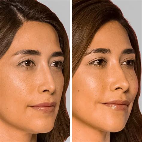 Contouring the Cheeks