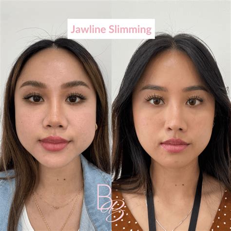 Contouring for a More Defined Jawline