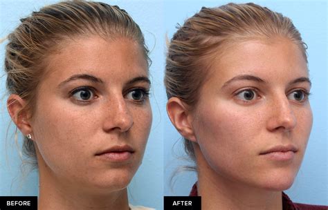 Contouring for a More Defined Jawline