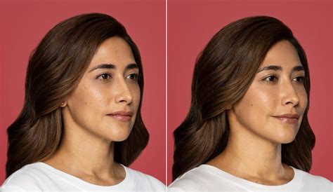 Contouring Options