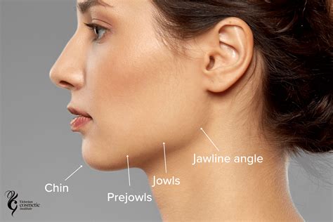 Defining the jawline