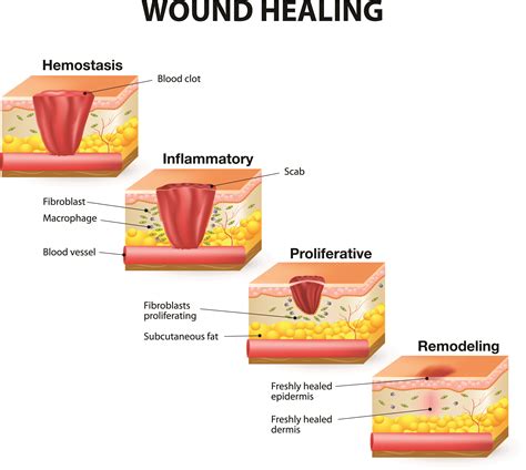 The process of healing