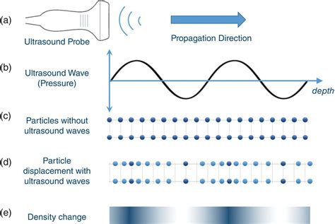 Knot detection and sound waves