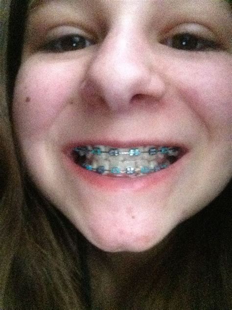 navy blue white braces