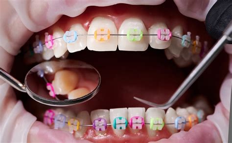 Orthodontic Expertise