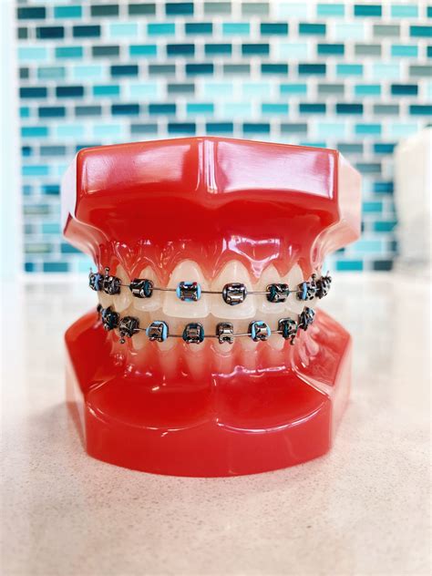 red silver braces