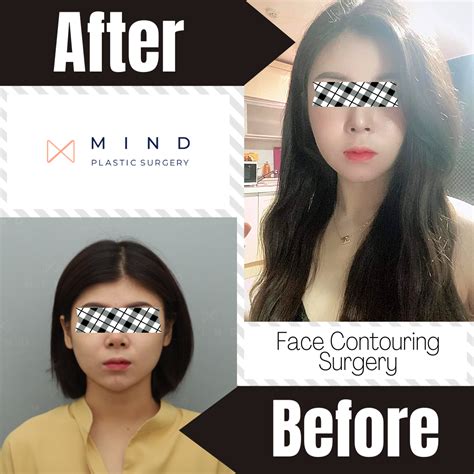 Slim Face Contouring Techniques